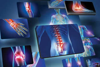 TESTIMONIANZE categoria ARTRITE