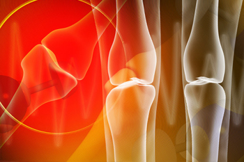 TESTIMONIANZE categoria DOLORI ARTICOLARI